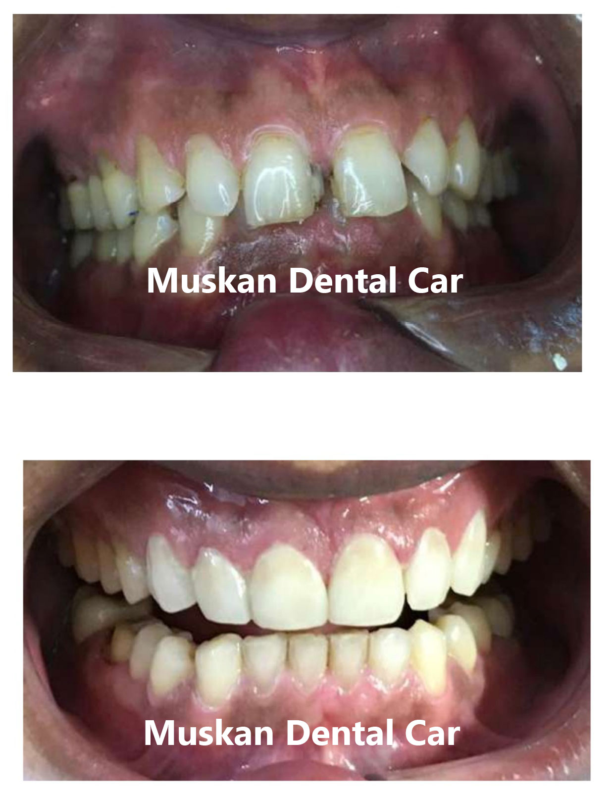 muskan dental care delhi24