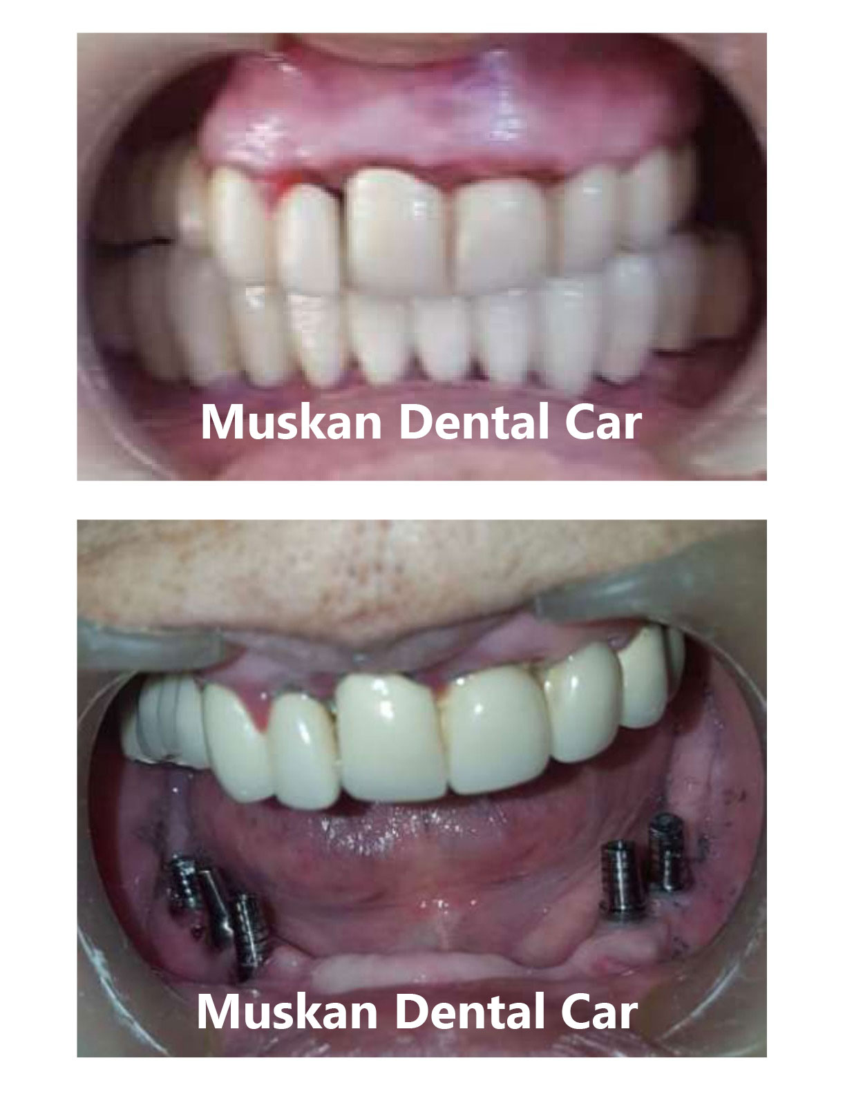 muskan dental care delhi24