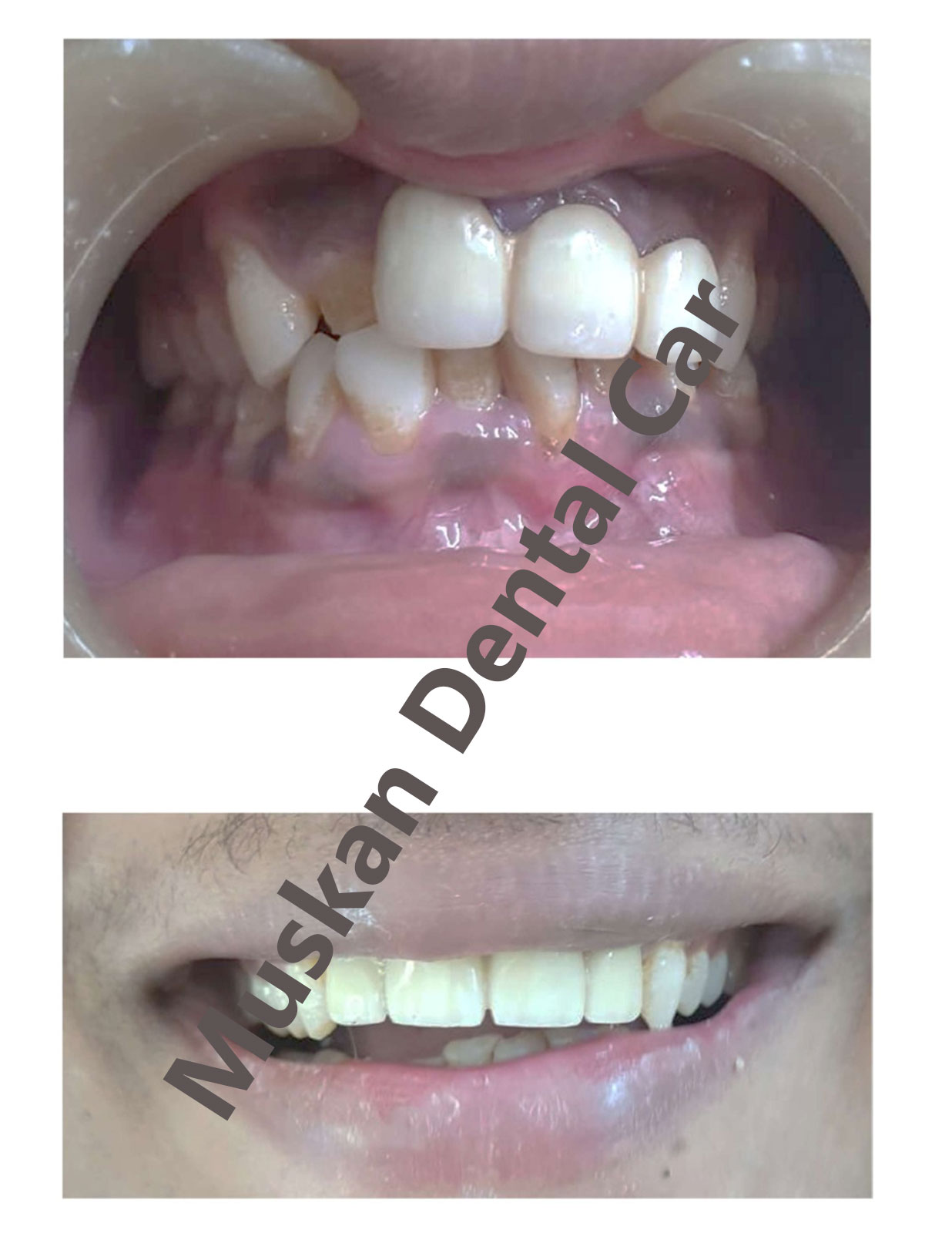 muskan dental care delhi24