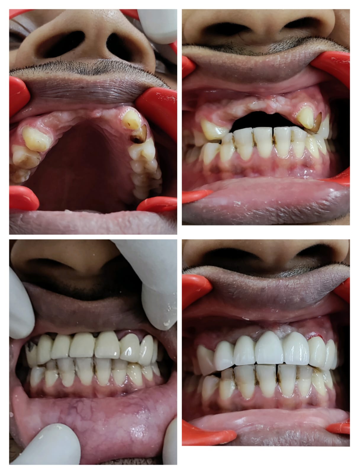 muskan dental care delhi4