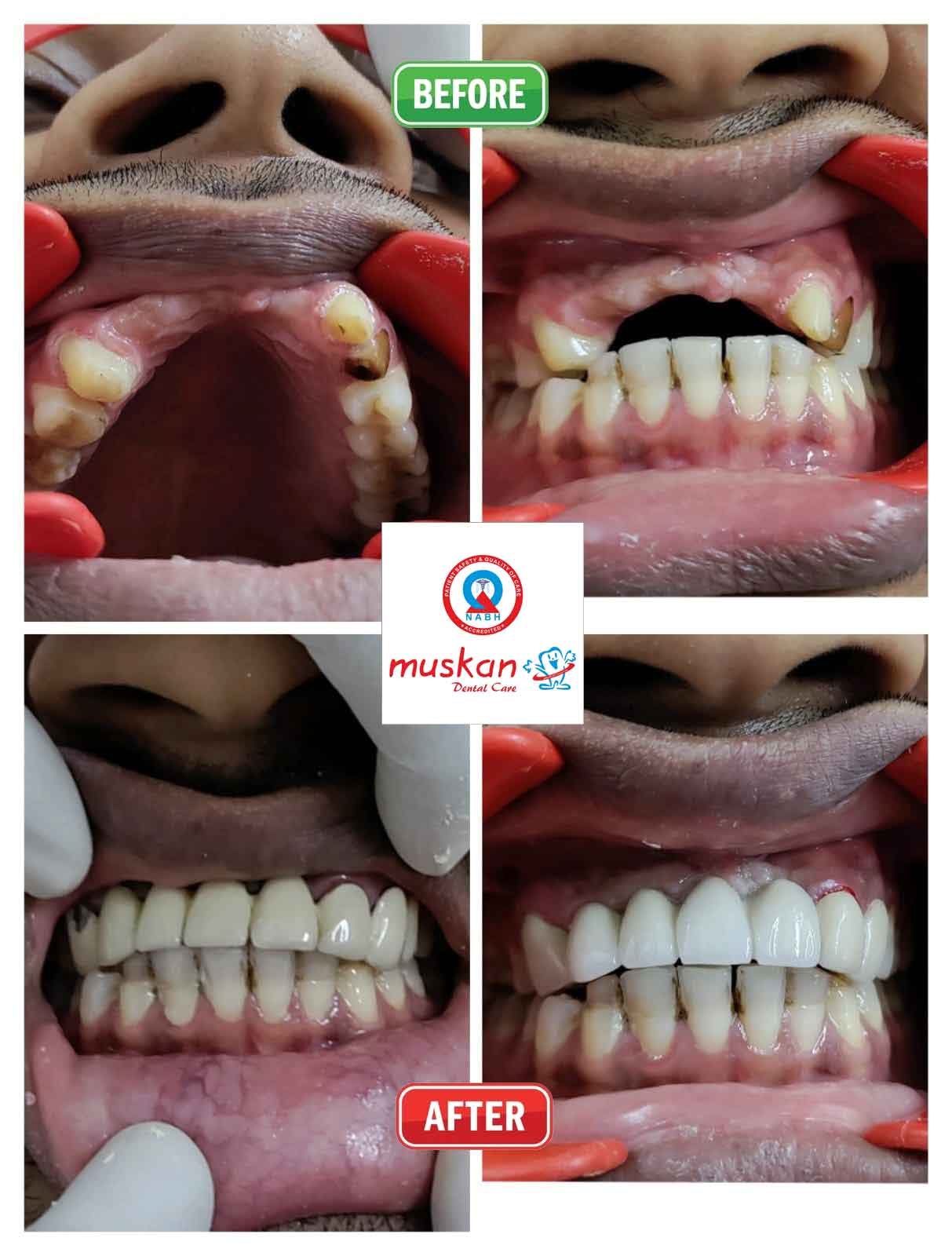 muskan dental care delhi4