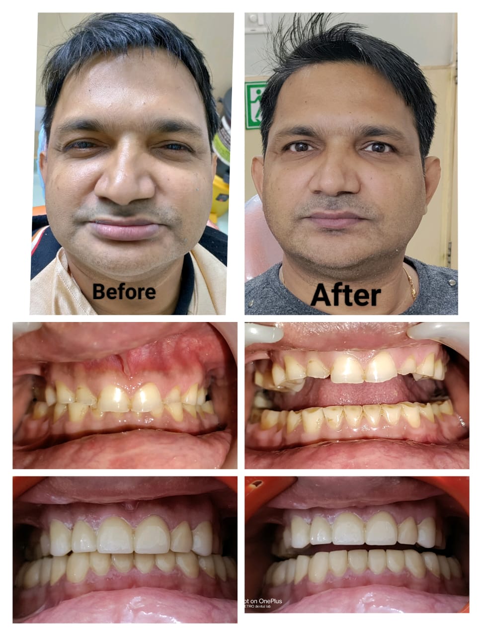 muskan dental care delhi4