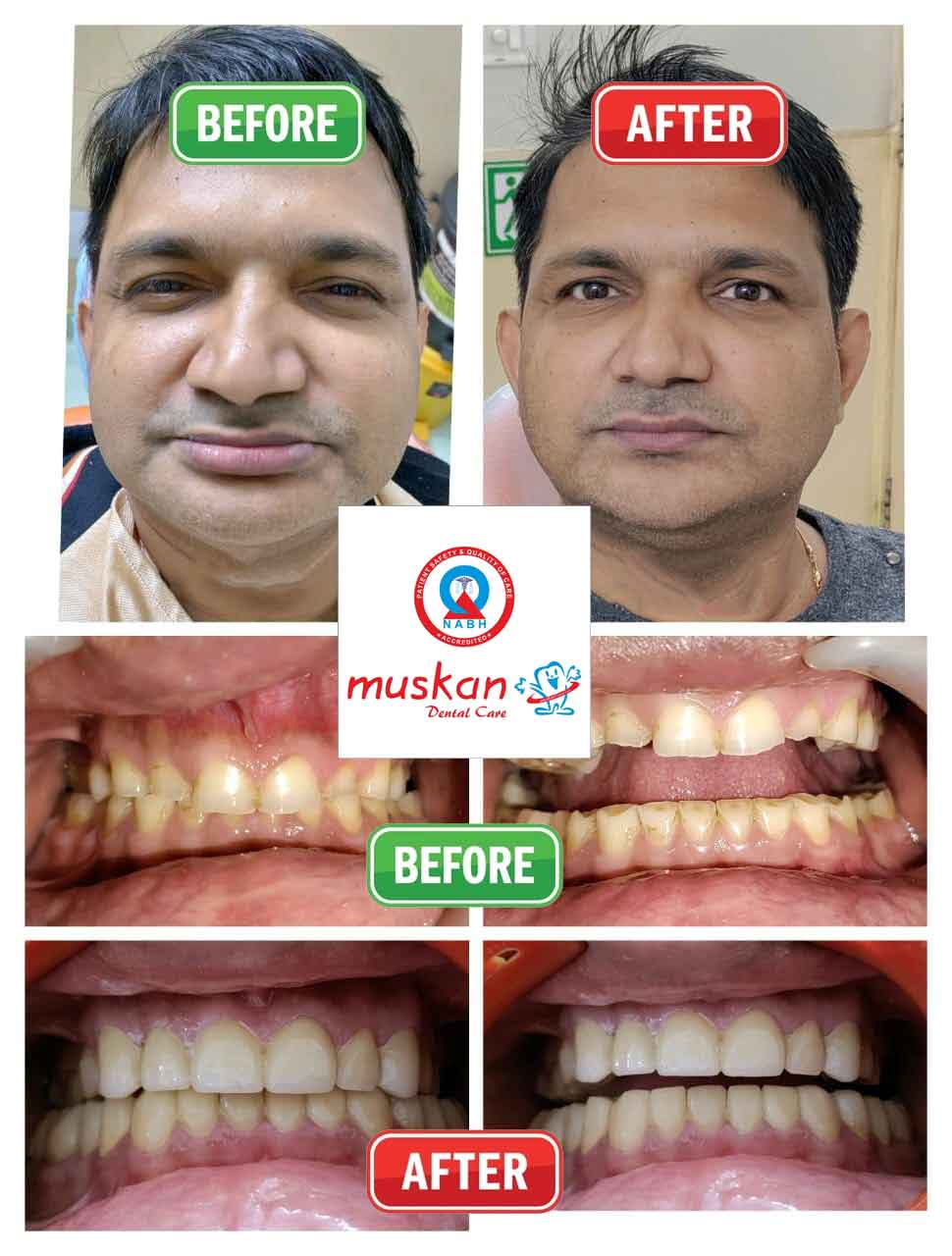muskan dental care delhi4