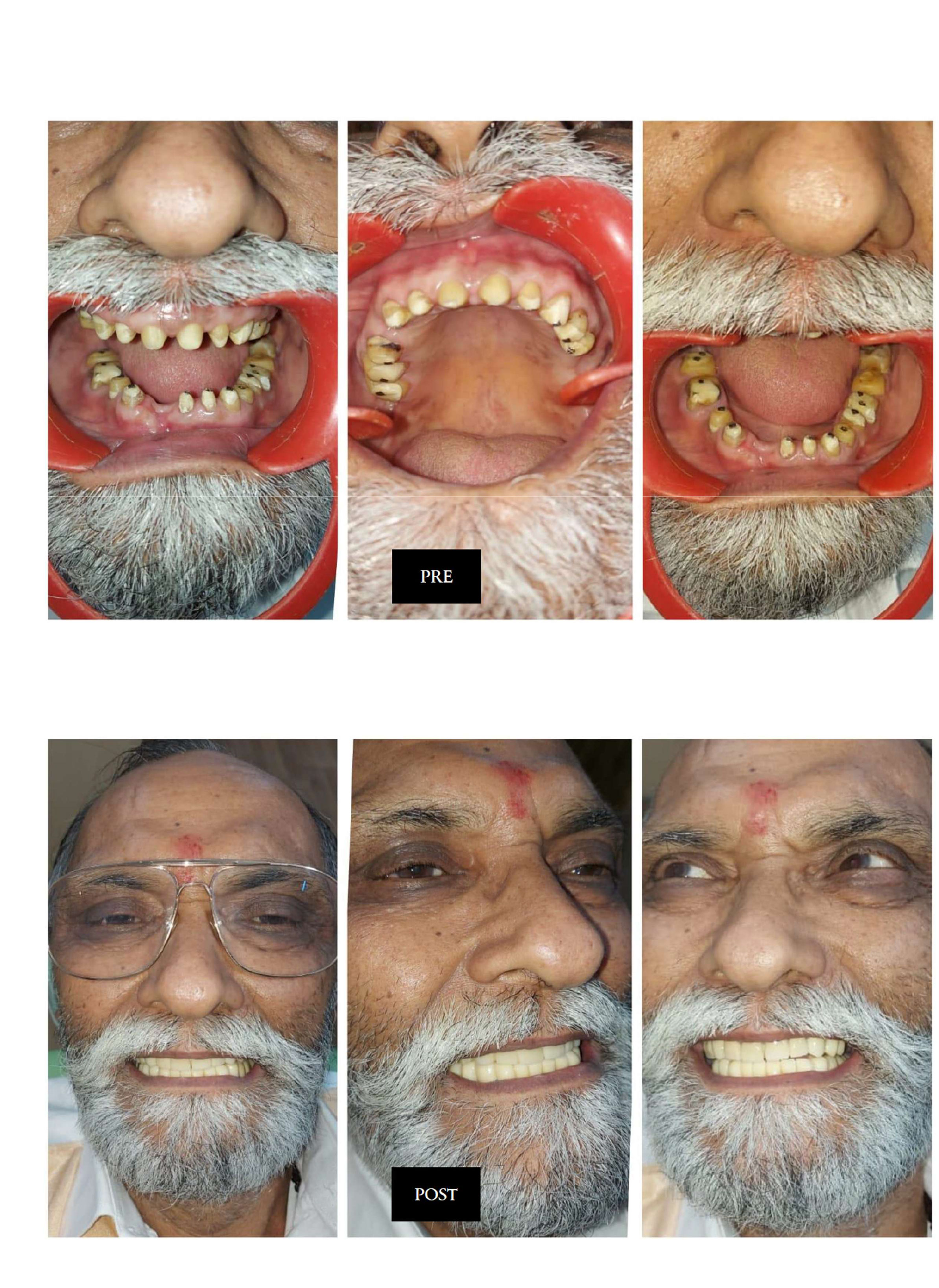 muskan dental care delhi4