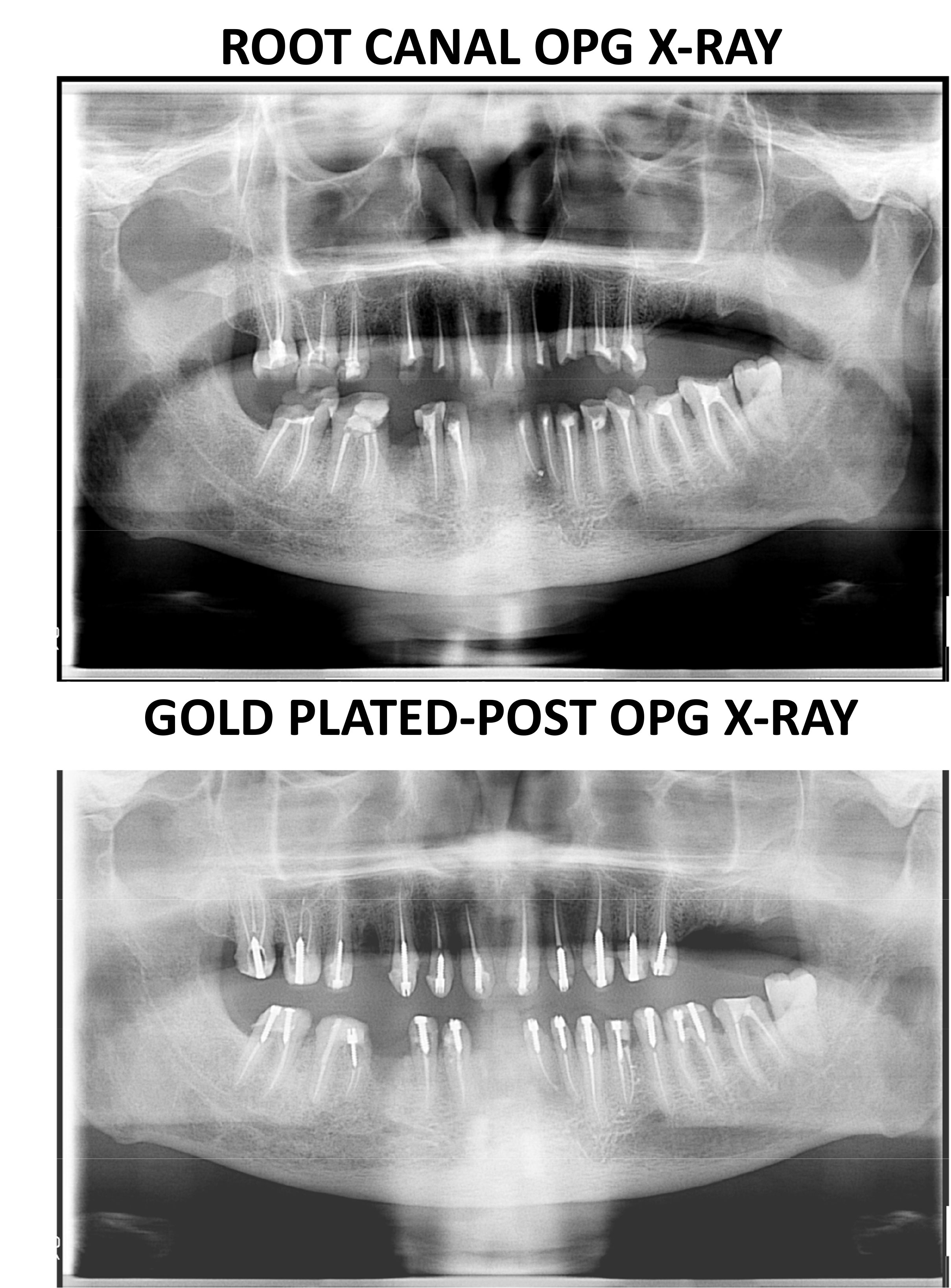 muskan dental care delhi4