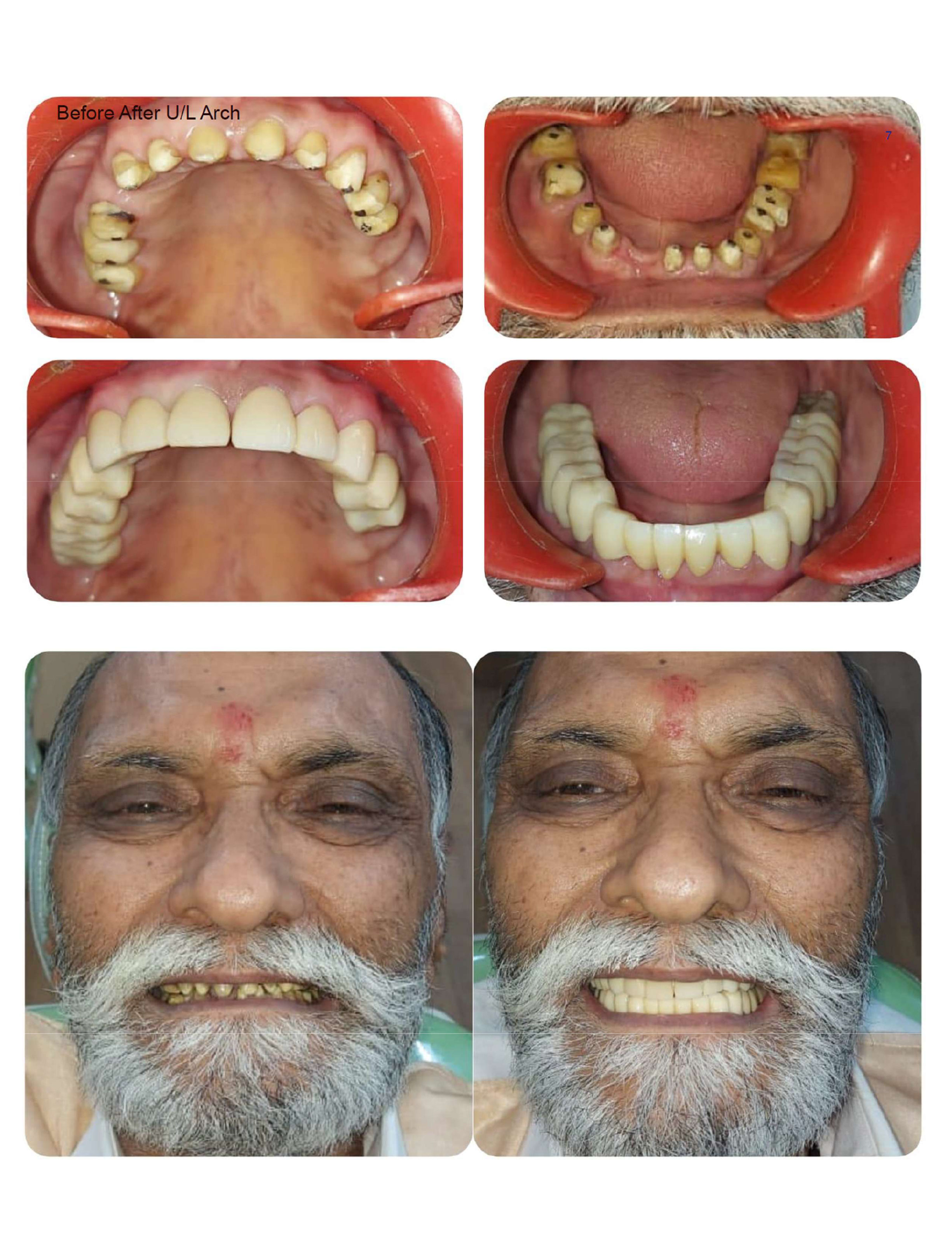 muskan dental care delhi4