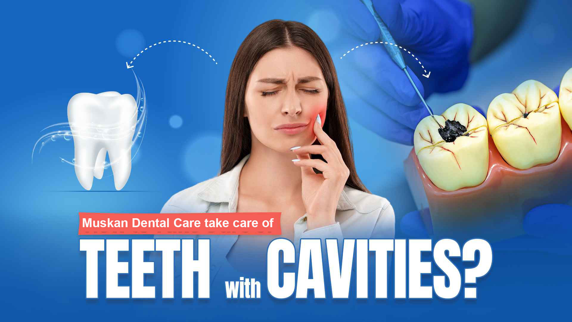 Take-Care-Teeth-with-Cavities-Muskan-Dental-Care